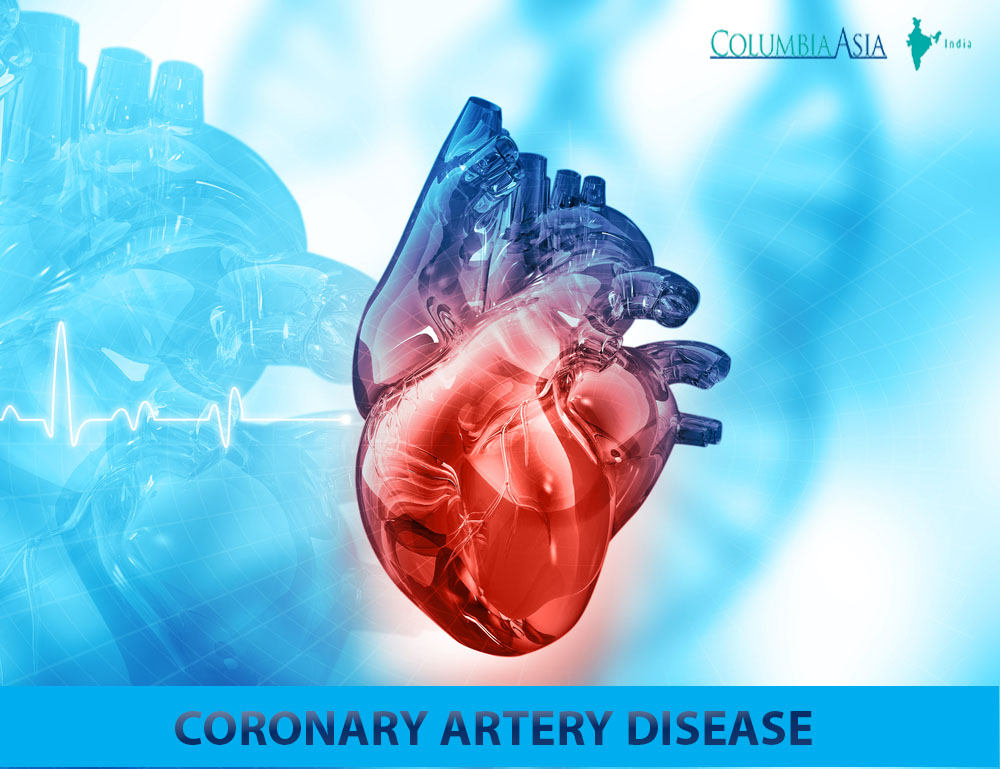 CORONARY ARTERY DISEASE