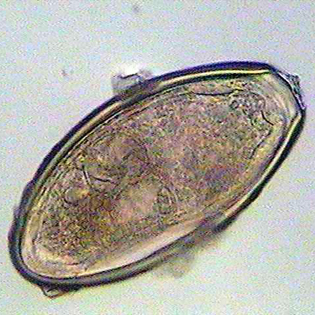 oxyuris equi huevos