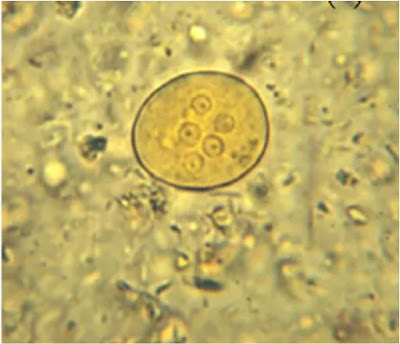 ￼ Entamoeba histolytica under compound microscope