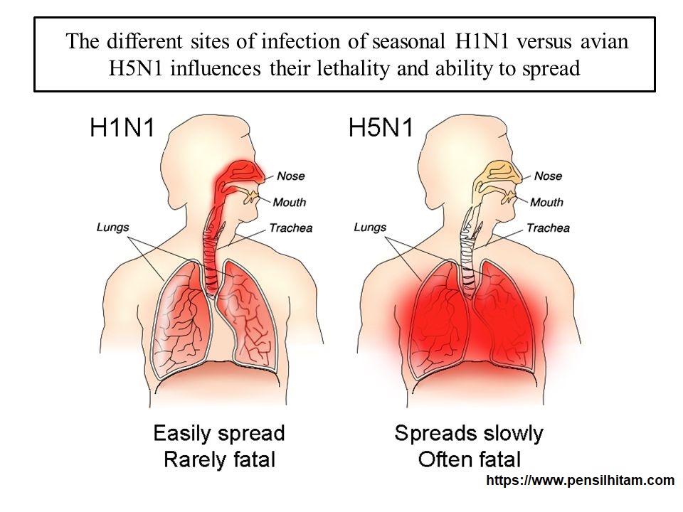Obat untuk Mengobati Flu Burung