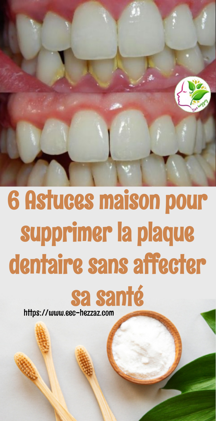 6 Astuces maison pour supprimer la plaque dentaire sans affecter sa santé