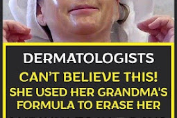 DERMATOLOGISTS CAN’T BELIEVE THIS! SHE USED HER GRANDMA’S FORMULA TO ERASE HER WRINKLES IN 3 DAYS