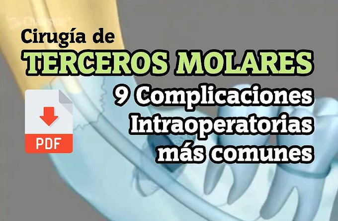 PDF: Cirugía de Terceros Molares - 9 Complicaciones Intraoperatorias más comunes