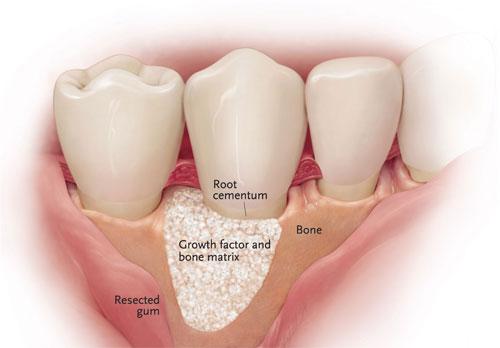 DentalStudioİstanbul Diş Sağlığı periodontoloji diş eti hastalıkları