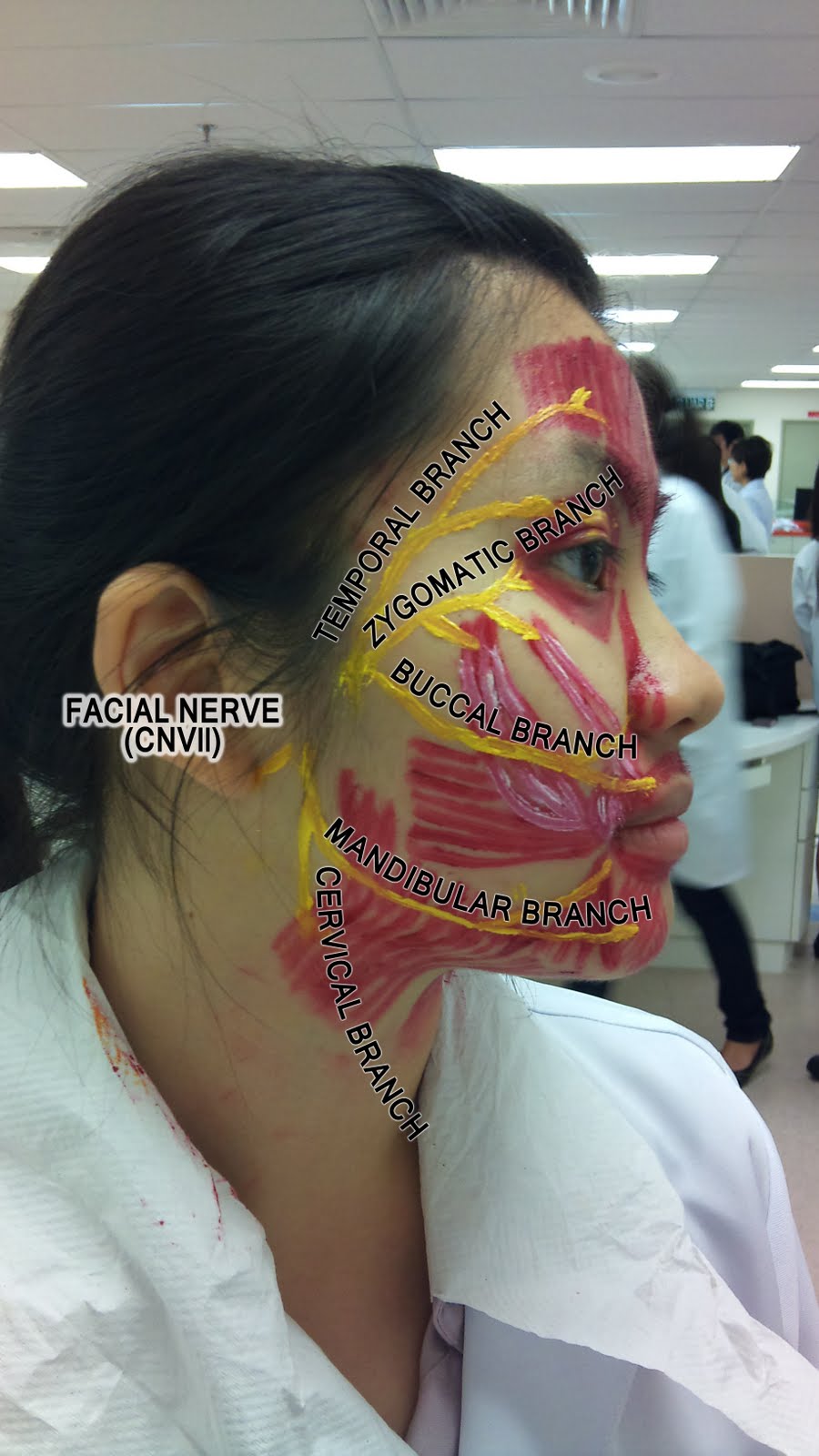 WizDent Muscles of Facial Expression & Facial Nerve (Clinical Session)