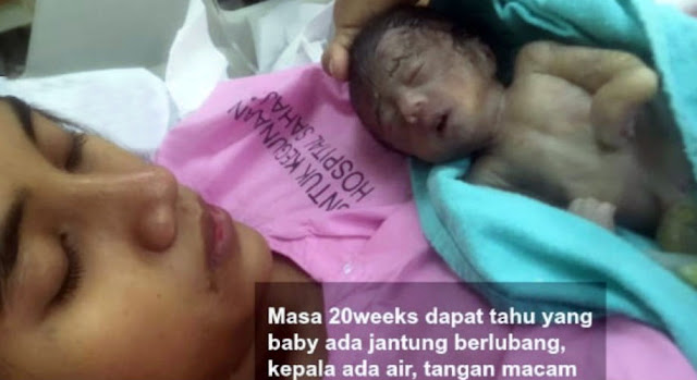 Innalillahi, Bayi Sulit Dilahirkan, Setelah Bertemu Ustadz Ternyata...