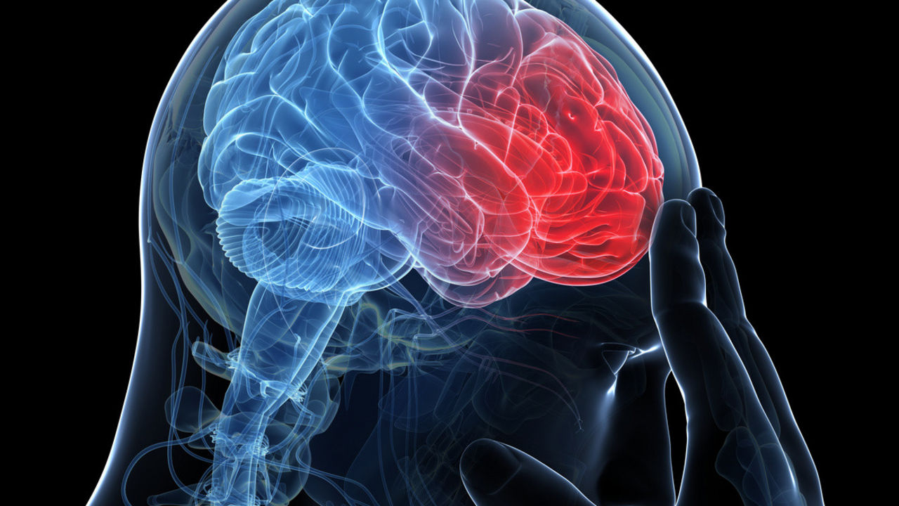 durchblutungsst rung gehirn - woodenbild :)