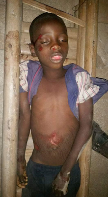 2 Photo: Unidentified young victim of hit-and-run dies in Yobe State