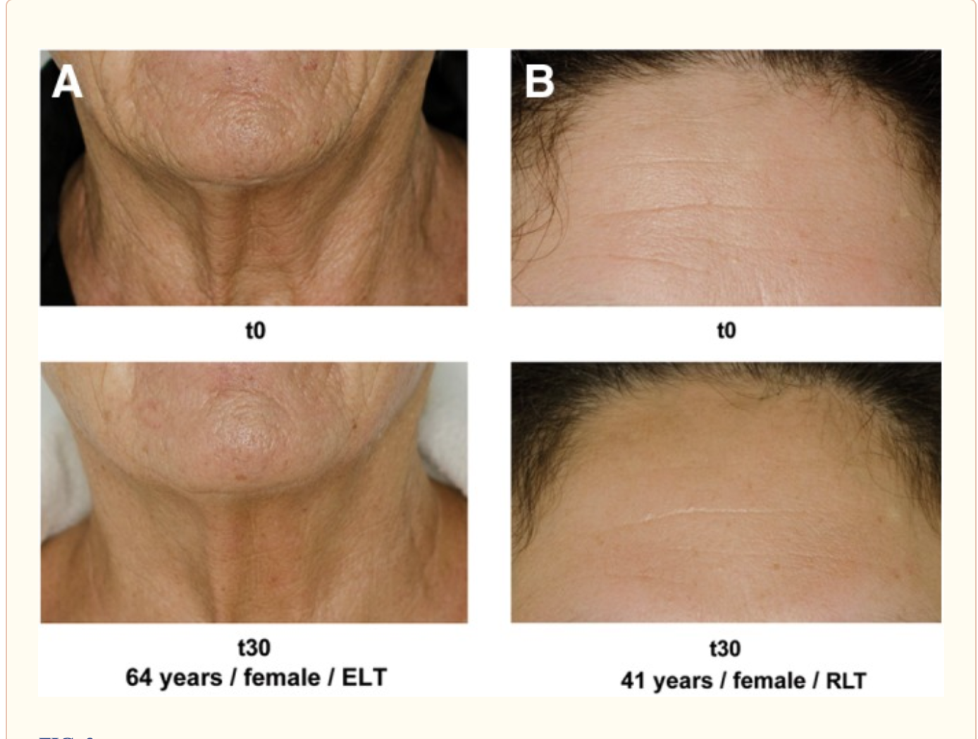 You Need to be using a Red Light Therapy Panel at Home. Here's Why