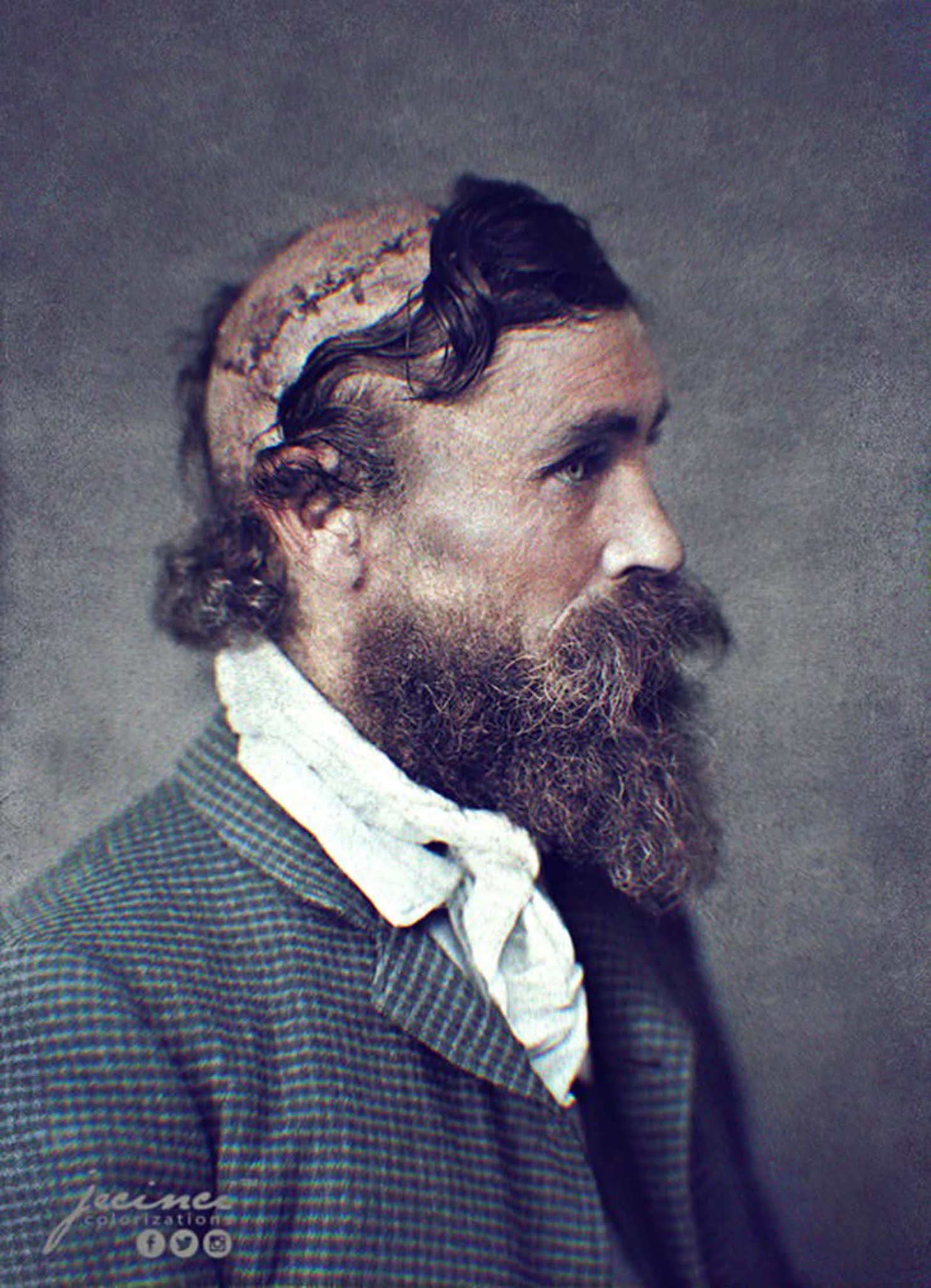 robert mcgee scalped