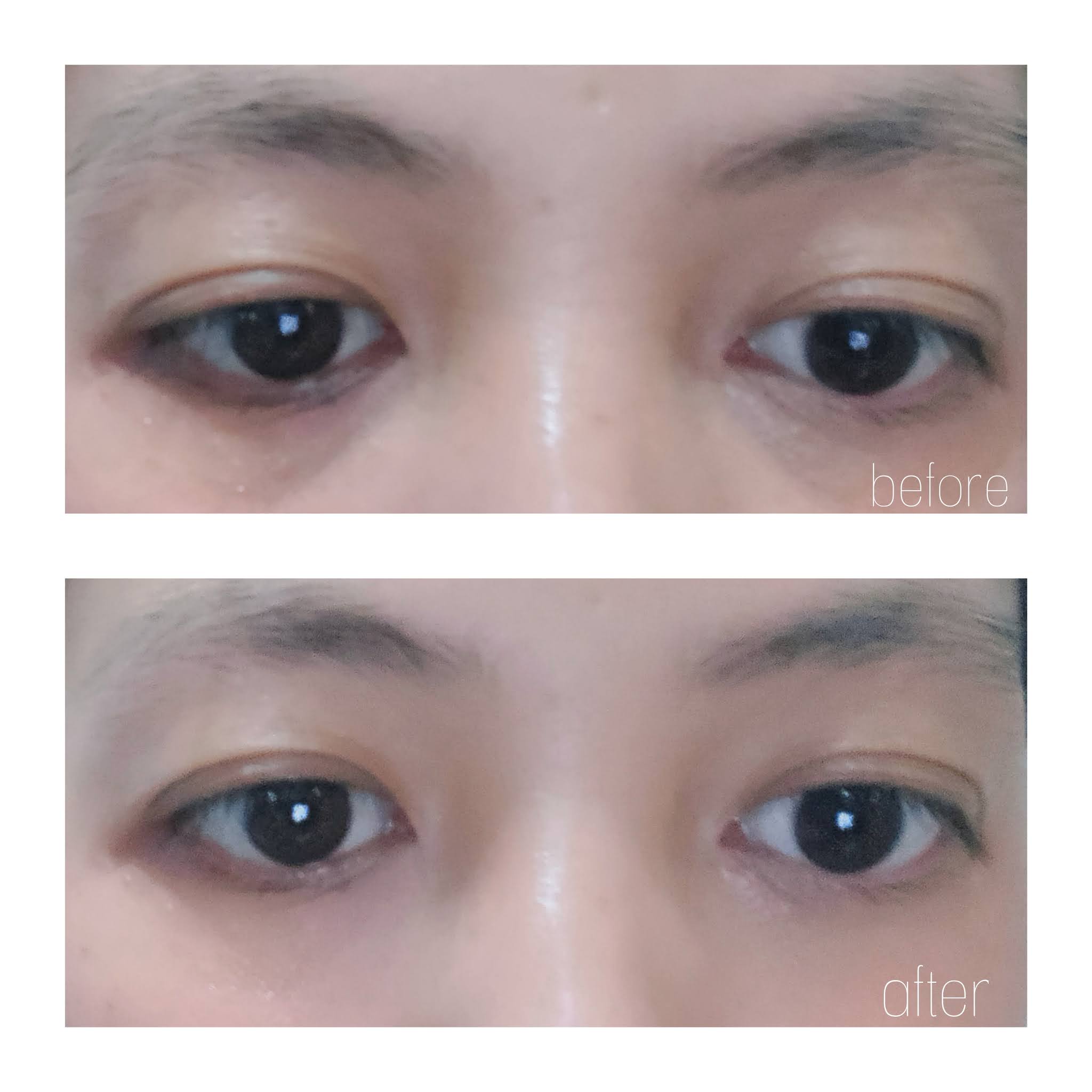 Aya Choiriyah Eye Cream Lokal Terbaik Untuk Mengatasi Mata Panda