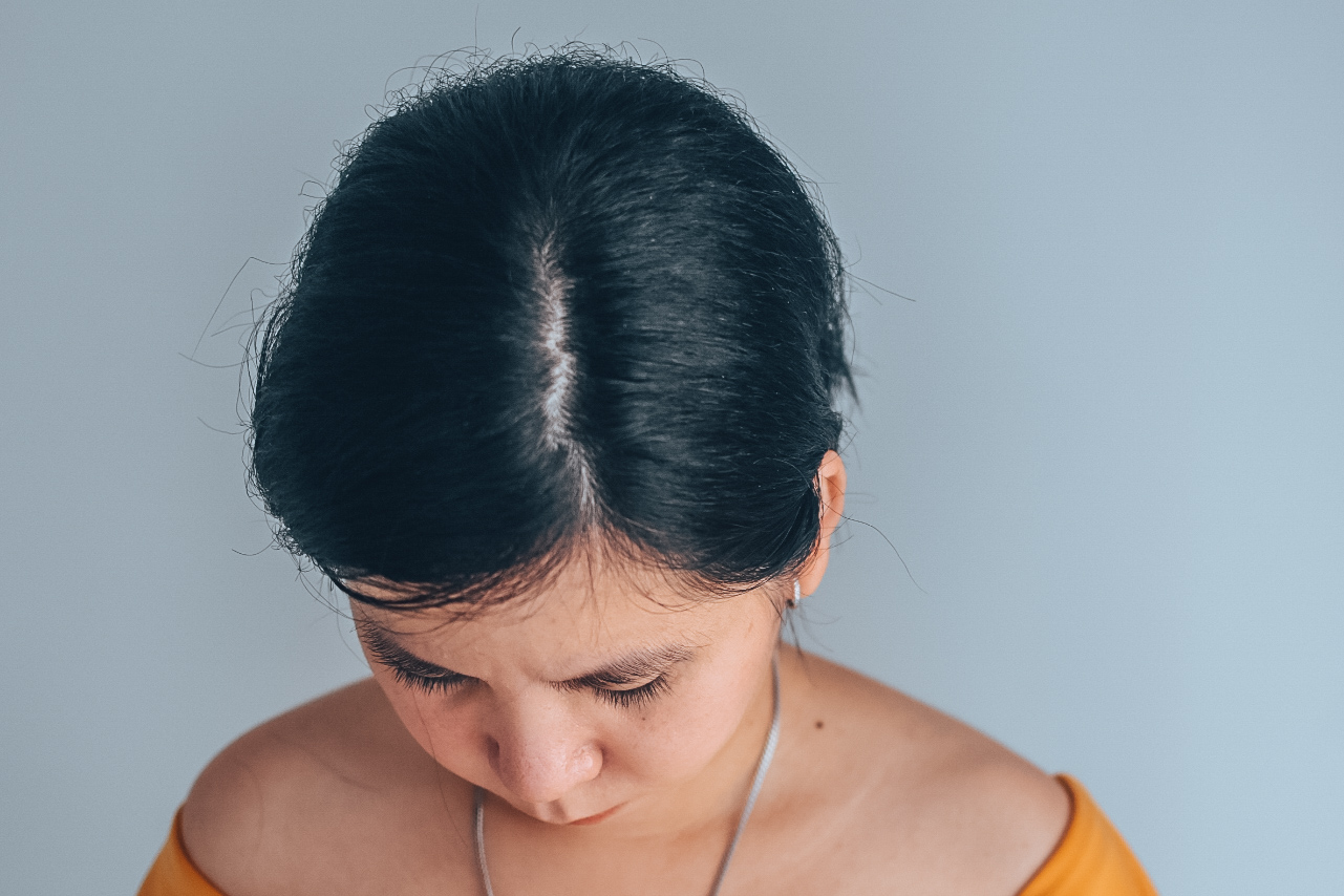 Top 10 Tips To Help You Increase Hair Volume Naturally  Vedix
