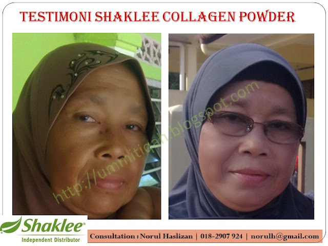cara atasi masalah jeragat tebal di muka tanpa side effect cara atasi masalah jeragat tebal di muka tanpa side effect