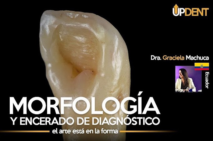 Morfología y encerado de diagnóstico - Videoconferencia Dra. Graciela Machuca