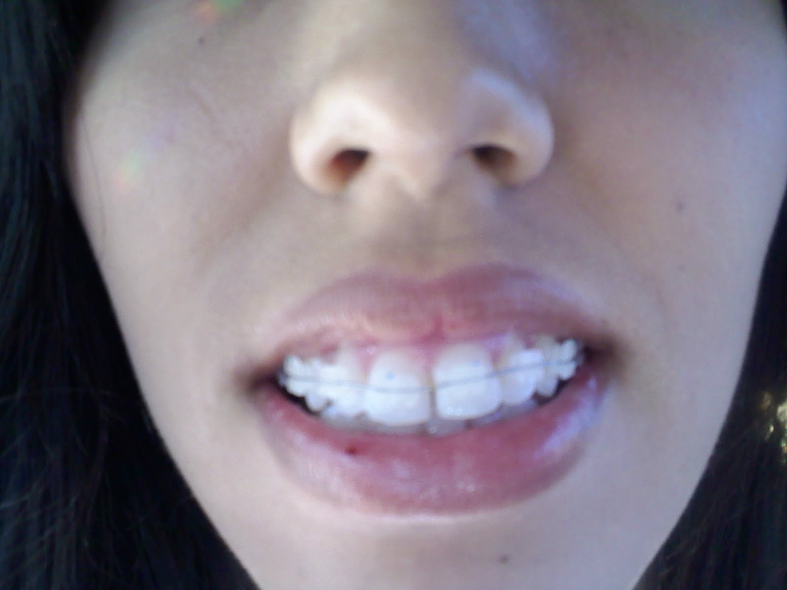 It's A Wonderful Life bRaCeS!!!!!