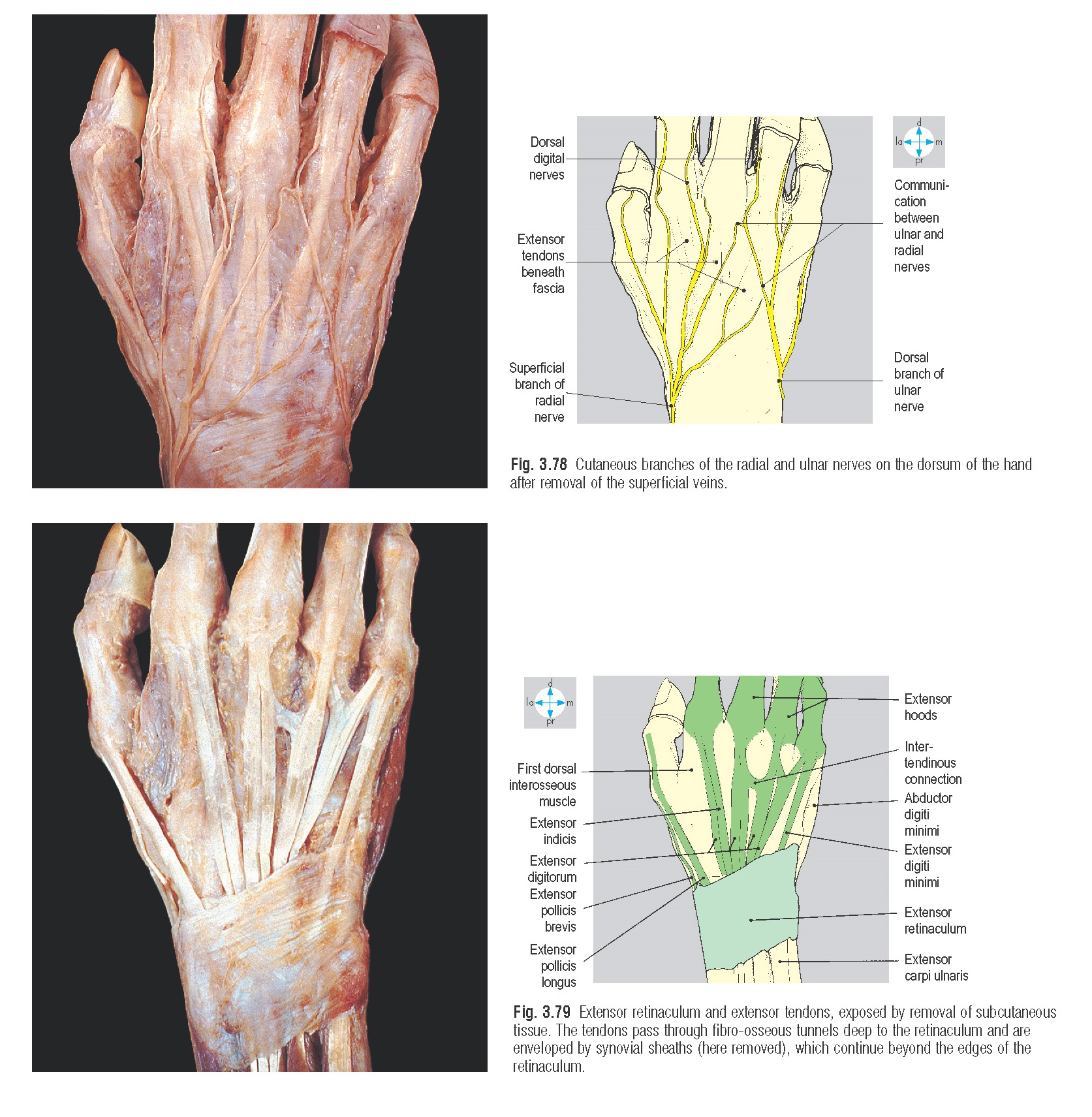 Dorsum of the Hand Anatomy