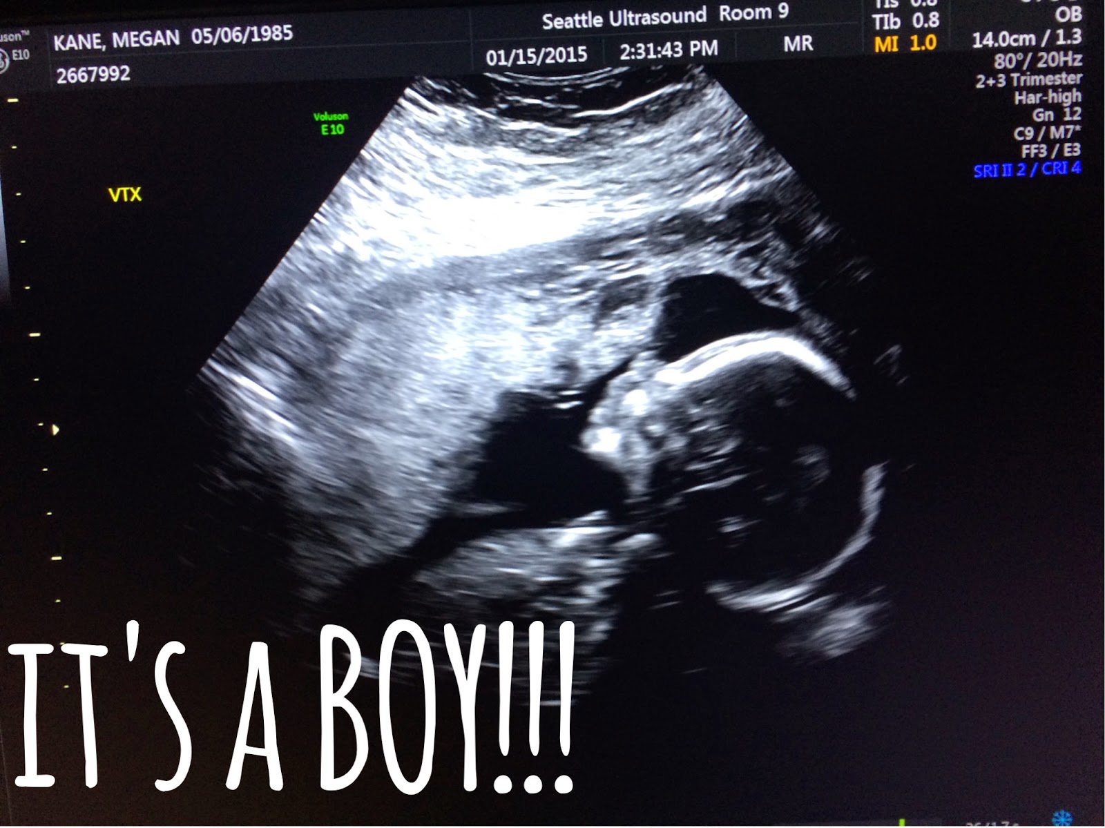 make bake and love Hello There! + 20 Weeks with the Gummy