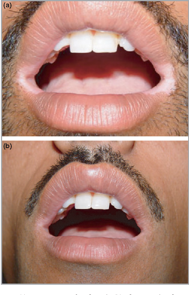 skin diseases and treatment