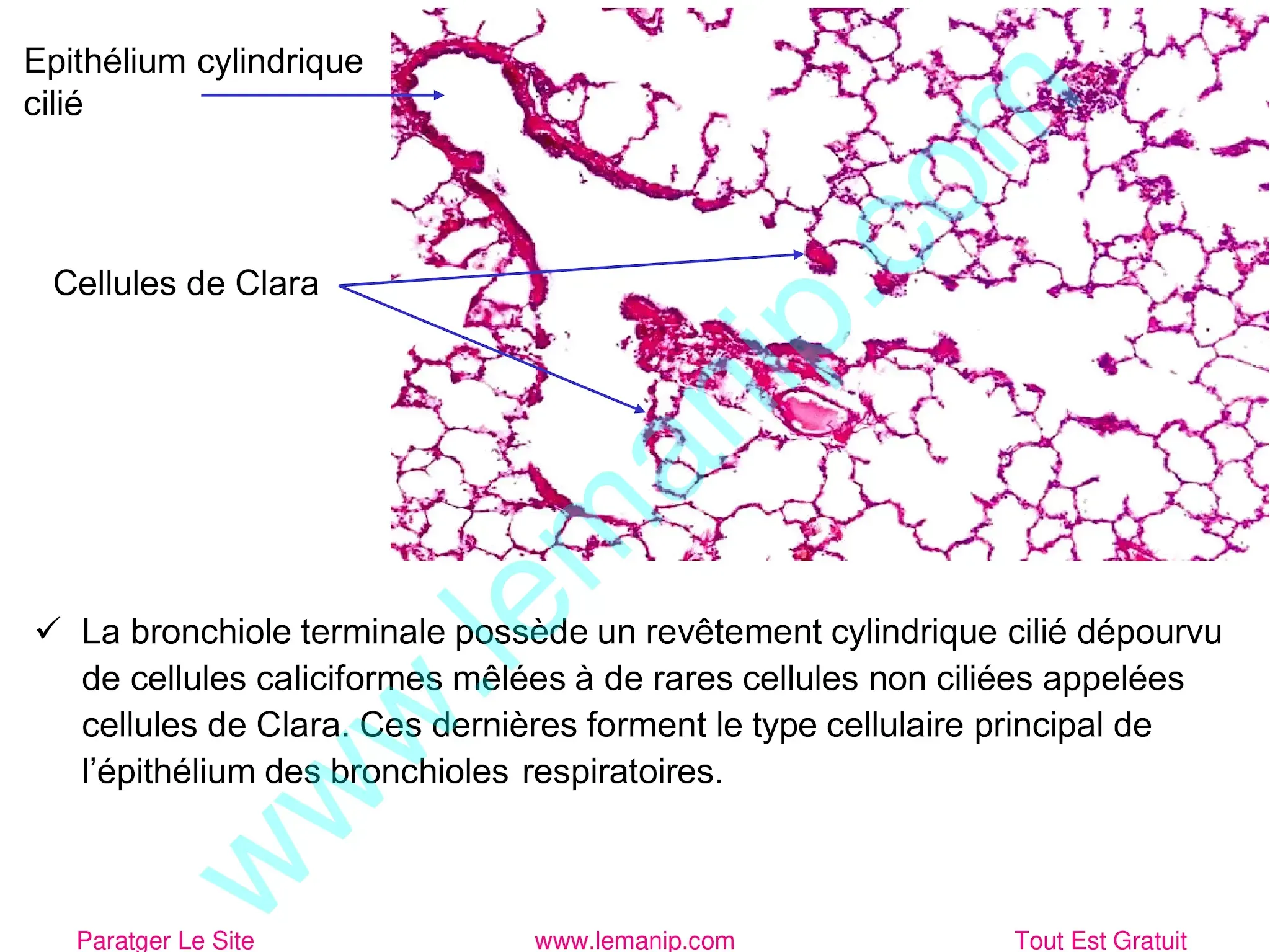 bronchiole terminale 1