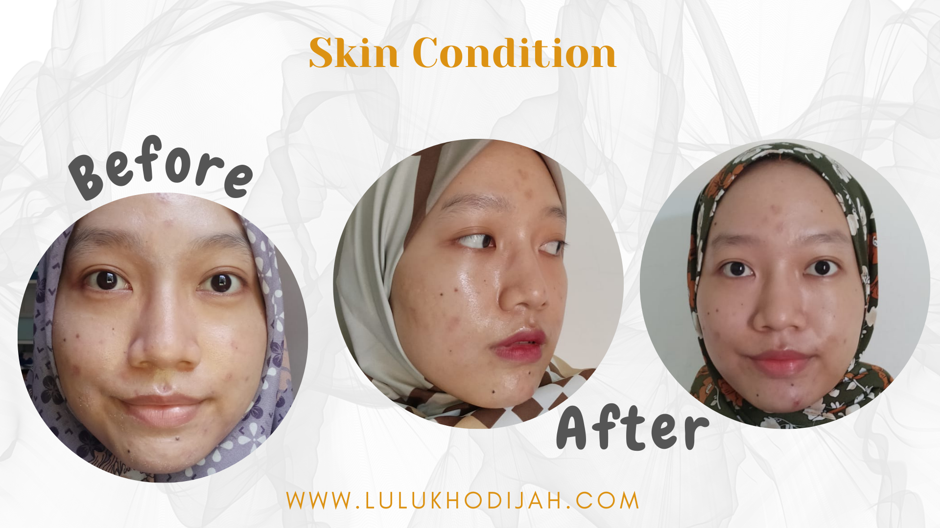 Review BASE Skincare Aman untuk Remaja A Lifelong Journey by Lulu