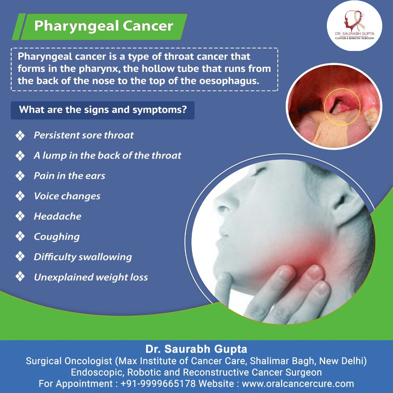 Dr. Saurabh Gupta Oncologist Signs & Symptoms of Pharyngeal Cancer