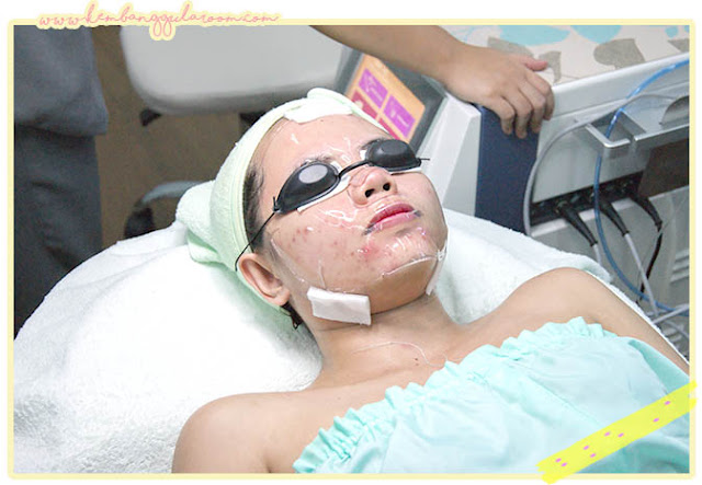 Ozone Jet Peel Facial