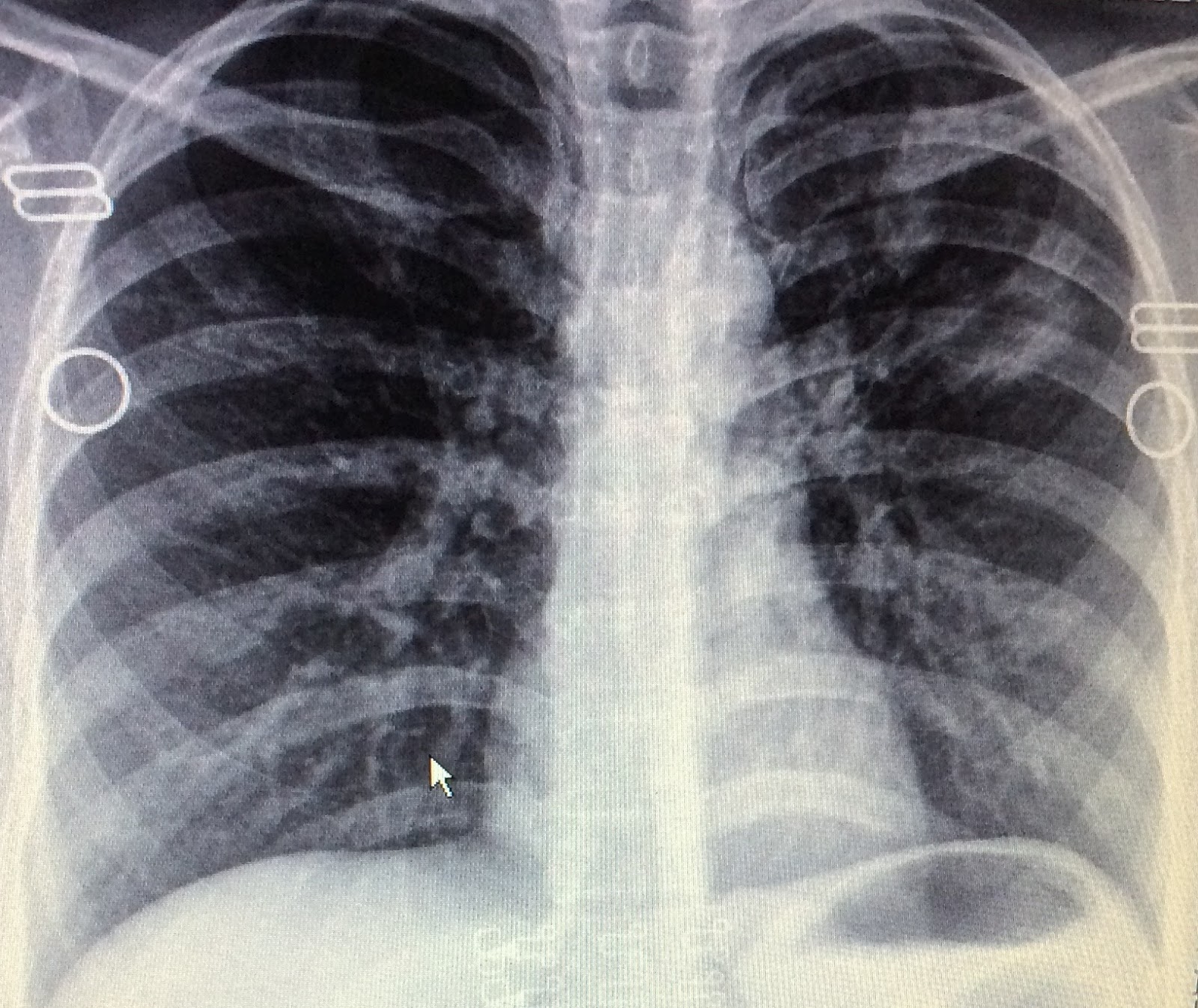 Journal of Postgraduate Gynecology & Obstetrics Atypical Presentation