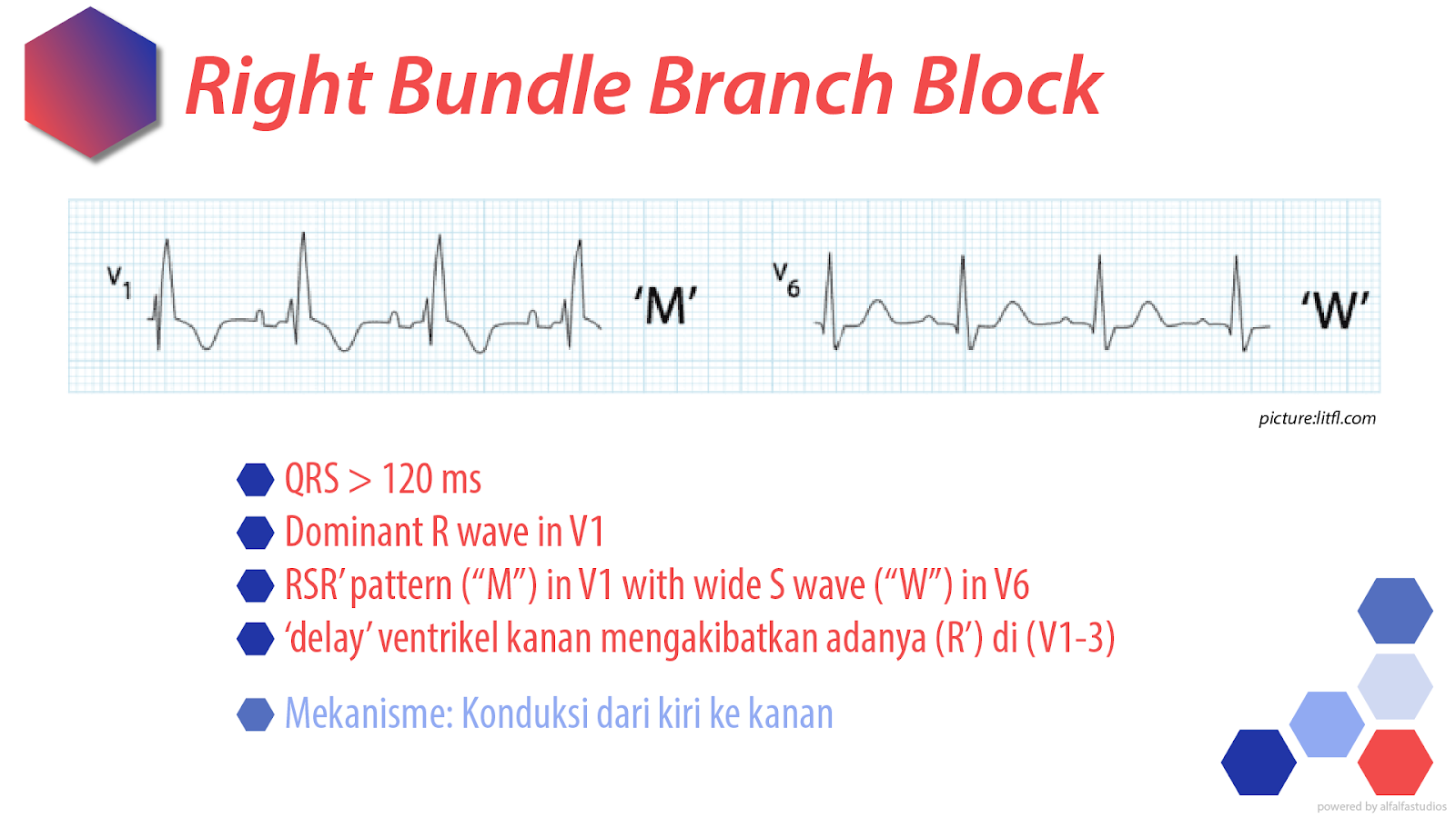 Conduction Block; AV Block & Bundle Branch Block; EKG Dokter