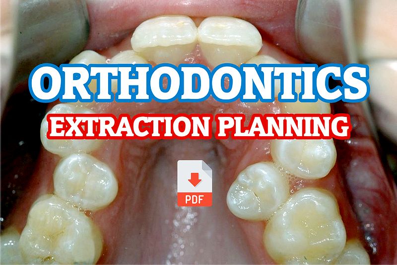 PDF Extraction Planning in Orthodontics