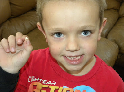 The Blackham Bunch: Baby Teeth