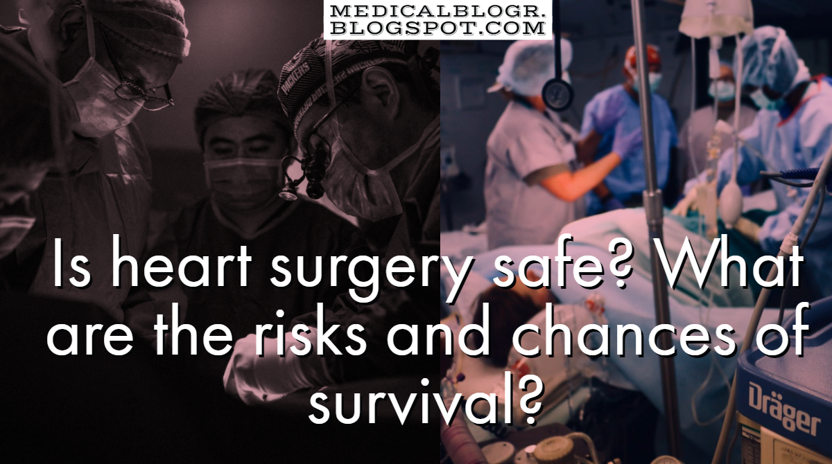 Is heart surgery safe? What are the risks and chances of survival?