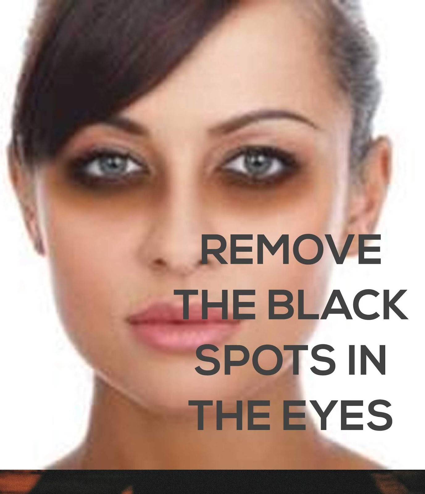Read World Viral News How To Remove The Black Spots In The Eyes