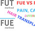 जानिये FUE और FUT Hair Transplant में बड़ा अंतर (Difference) हिंदी में