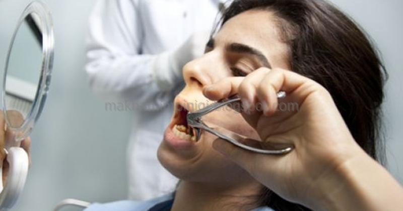 99 Arti Mimpi Cabut Gigi Berlubang atau Bolong Menurut Primbon Jawa dan