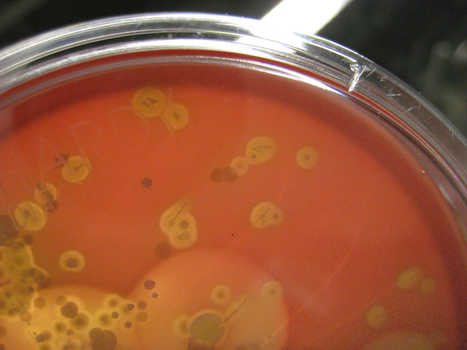 DVC Microbiology 146 Fall 11 (Gard) Lab 34 Throat Culture
