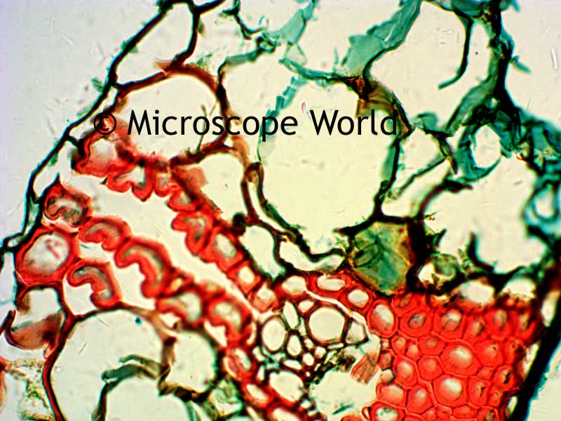 Wheat Leaf Rust at 200x magnification under the microscope.