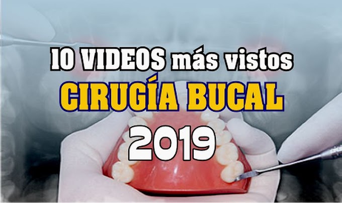 10 Videos de CIRUGÍA BUCAL más vistos en el 2019