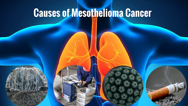 mesothelioma deaths uk