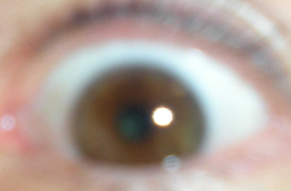 Mouse Droppings Eye Mouse