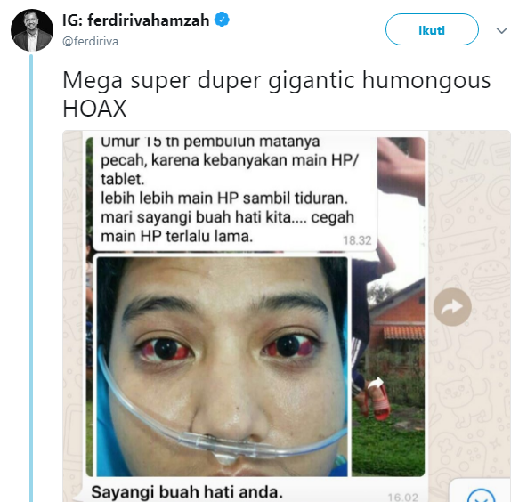 Berdarah-Darah, Matanya Bocah Karawang Diduga Akibat Kelamaan Main Hp! Ini Kata Dokter