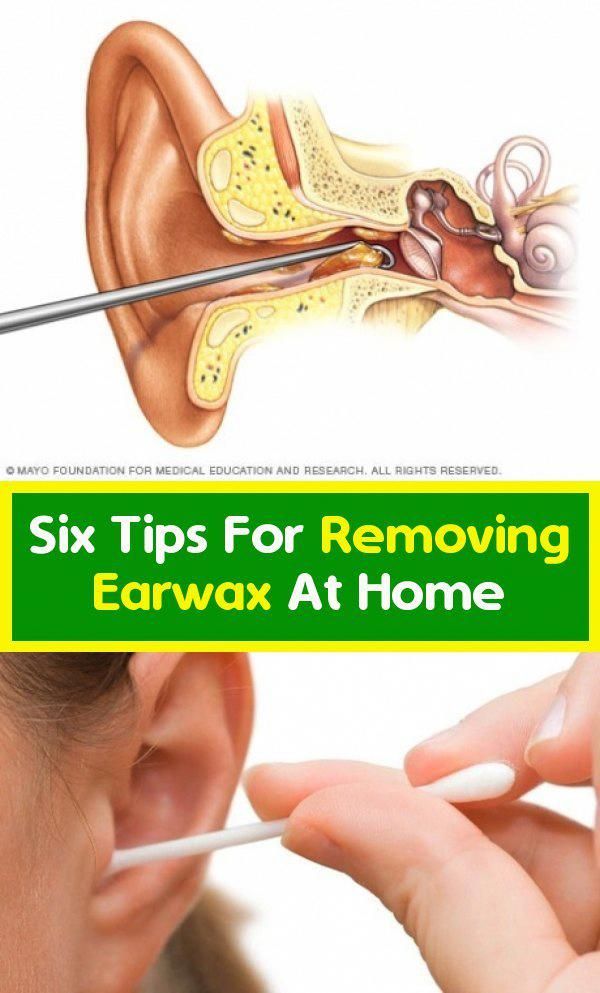 Causes And Tips For Removing Earwax At Home Instantly! wellness magazine