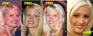 Holly Madison Before After