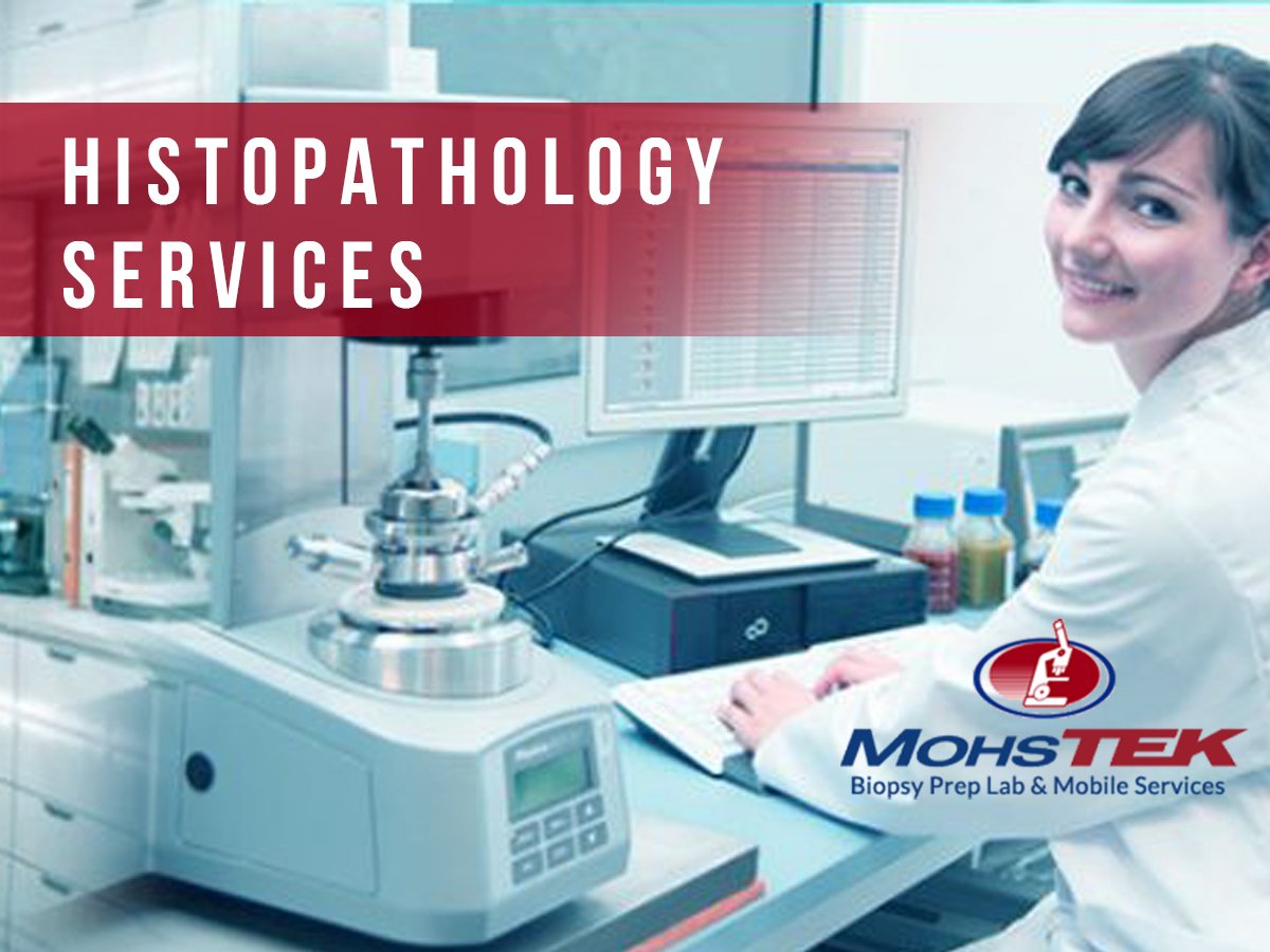 All about Histopathology Laboratory Test For the Diagnosis of Diseases