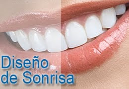 Odontología Estética - Maribel López Delgado, Odontóloga - Marbella