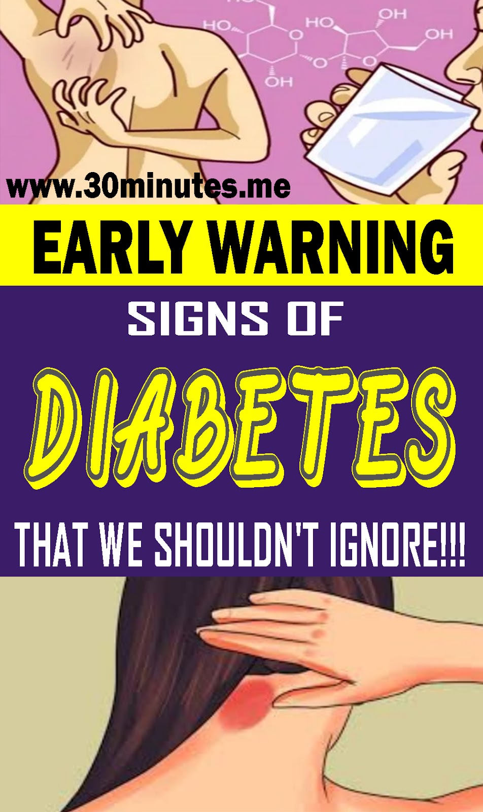Early Warning Signs of Diabetes That We Shouldn’t Ignore!!!