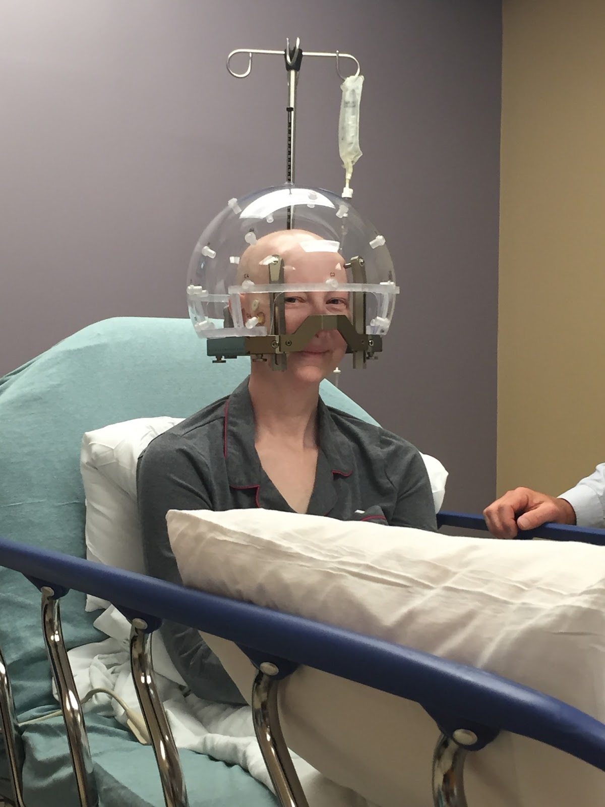 Ya Only Live Once A Survivor's Journey Gamma Knife Check!