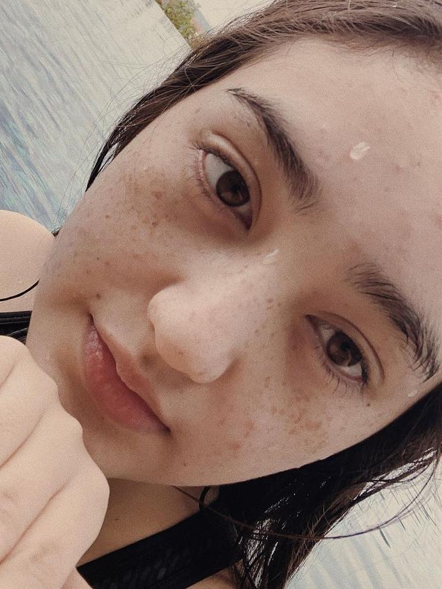 Ranty Maria dengan freckles di wajah cantiknya