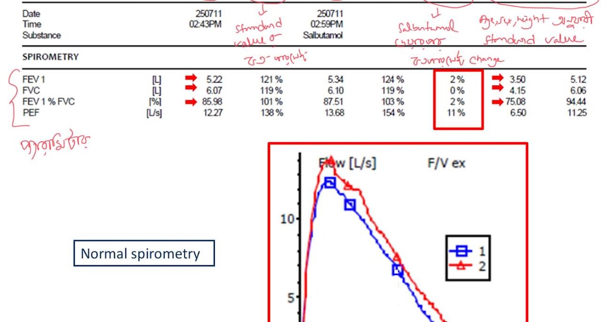 Spirometry MEDICAL NOTES