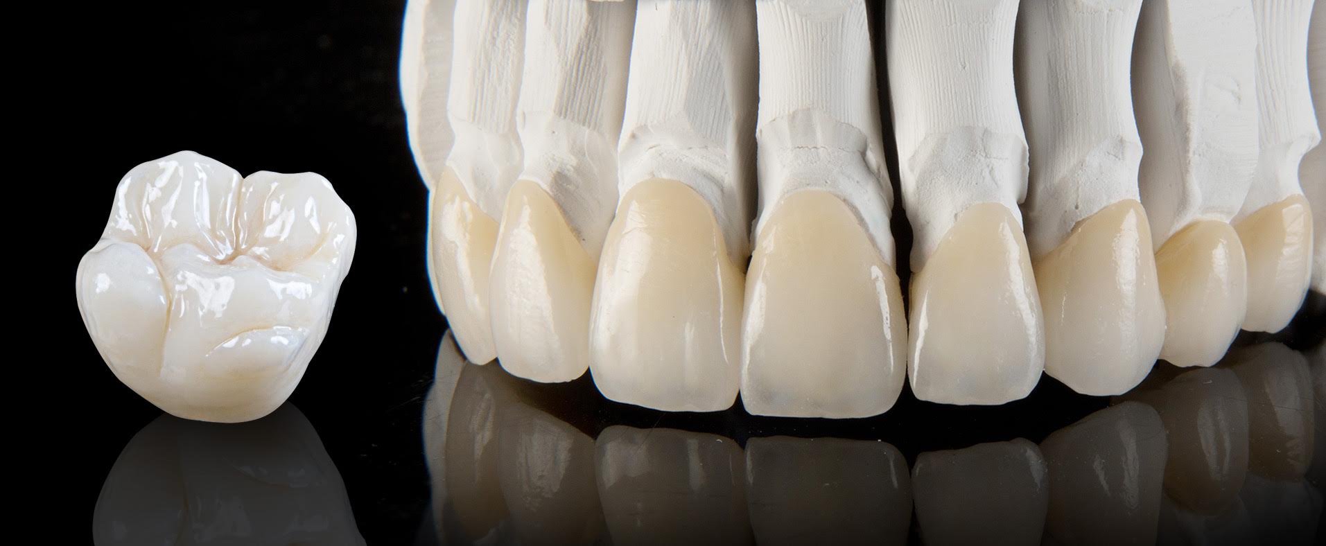 3M Lava Classic Zirconia Crown And Bridge Dr. Bharat Katarmal Dental