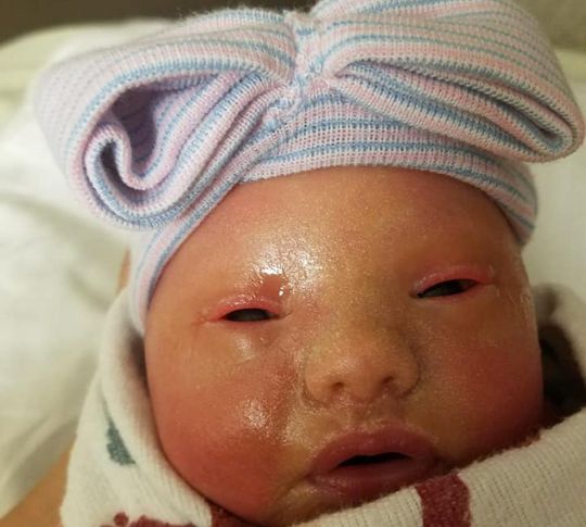 Fakta Viral! Bayi yang Dimandikan Dengan Pemutih Pakaian Oleh Ibu Kandungnya Fakta Viral! Bayi yang Dimandikan Dengan Pemutih Pakaian Oleh Ibu Kandungnya